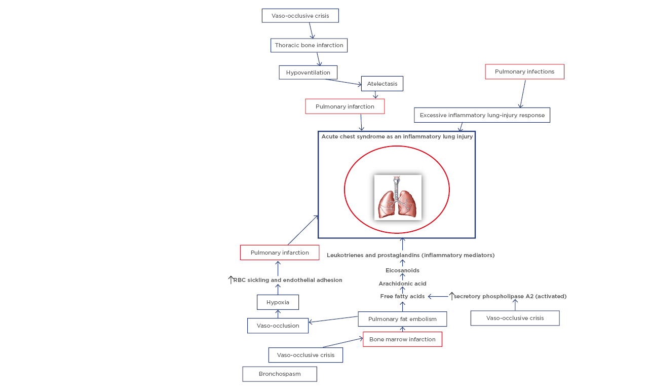 Editor's Pick: Acute Chest Syndrome in Children with Sickle Cell ...