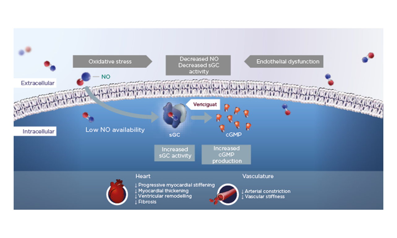 Left ventricular remodeling and dysfunction in primary aldosteronism