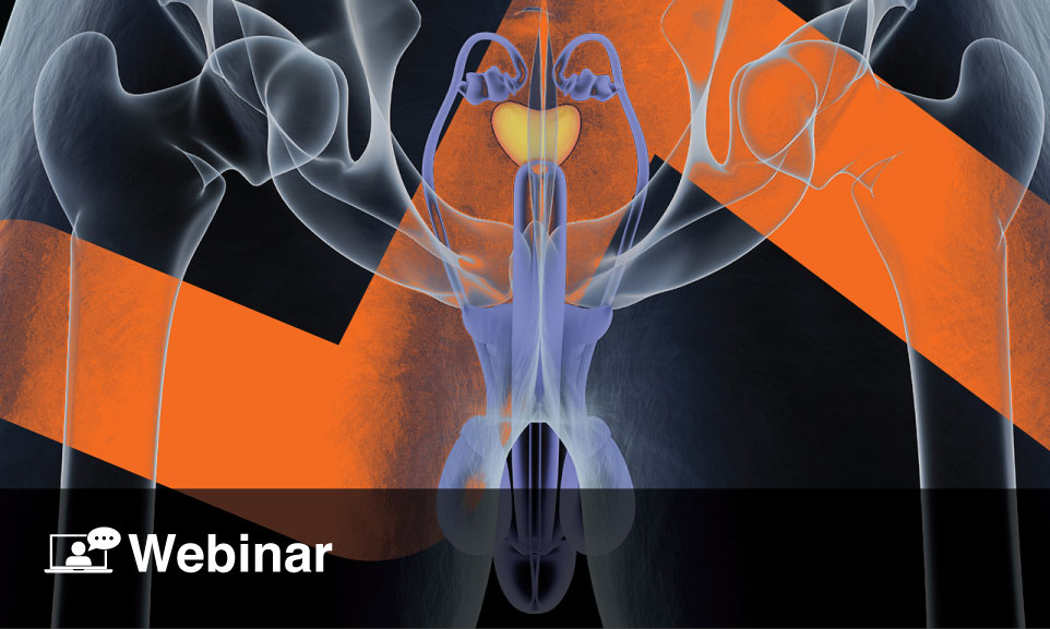 Webinar Holmium Laser Enucleation Of The Prostate Holep European