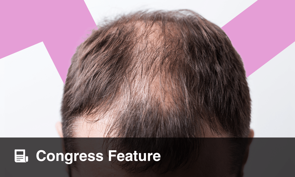 Early diagnosis, treatment key to prevent permanent baldness in