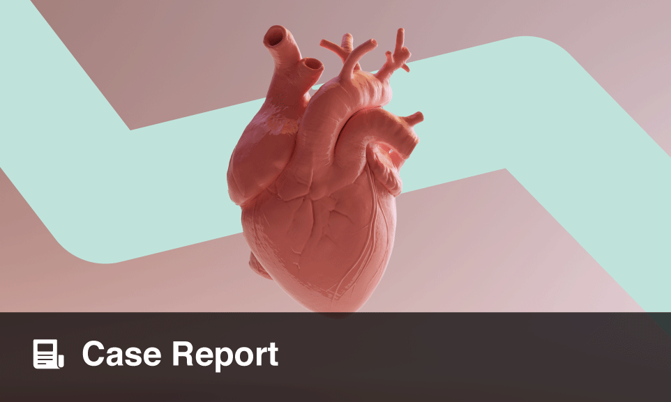 Percutaneous Coronary Intervention For Treatment Of Unusual Origin Of ...